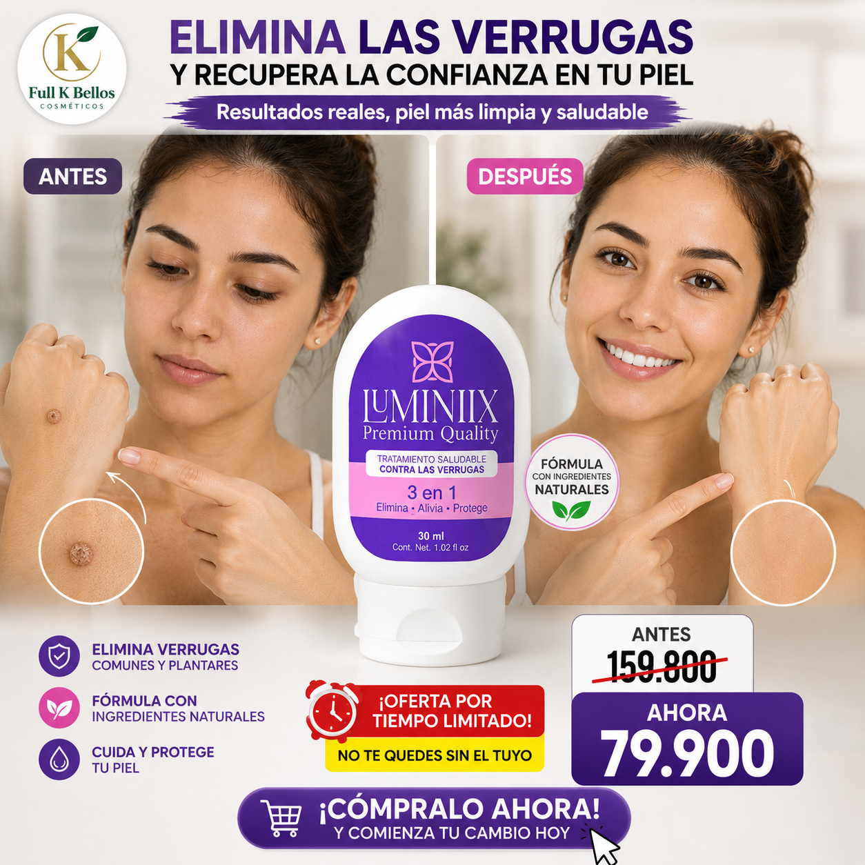Luminiix: Tratamiento tópico que ayuda a eliminar verrugas comunes y plantares.